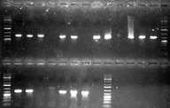 Gel electrophoresis image of mecA PCR results across multiple plasmids Gel electrophoresis image of mecA PCR results across multiple plasmids